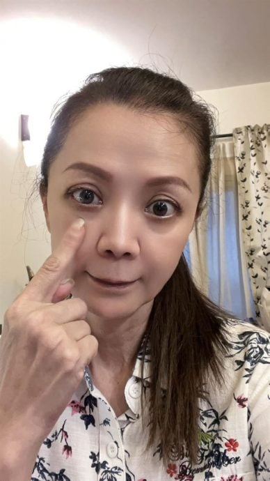 女星点错药水 右眼被灼伤险失明