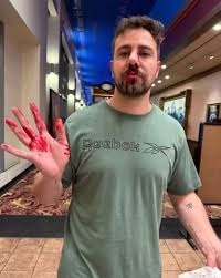 想好好看场电影这么难?男子劝青少年安静反被5人围殴