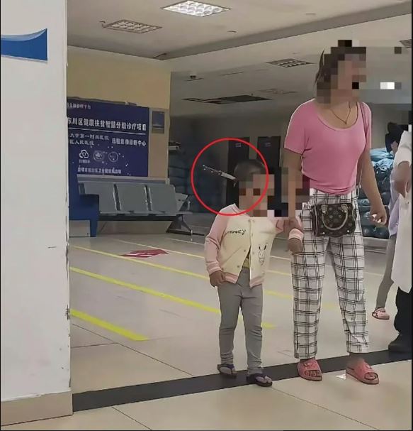 拚图)云南3岁女童头插水果刀 淡定进医院吓坏网民