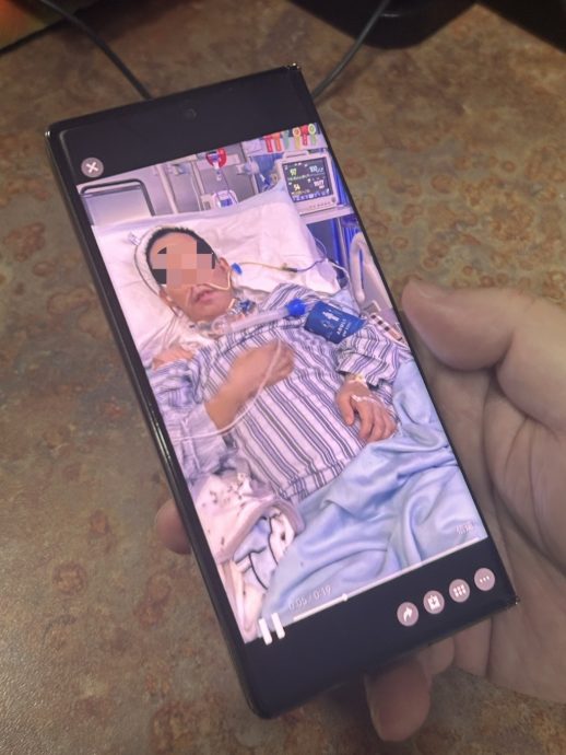 拼盘  全球罕见！上海医生救回“身首离断”患者　手术难度堪比登天