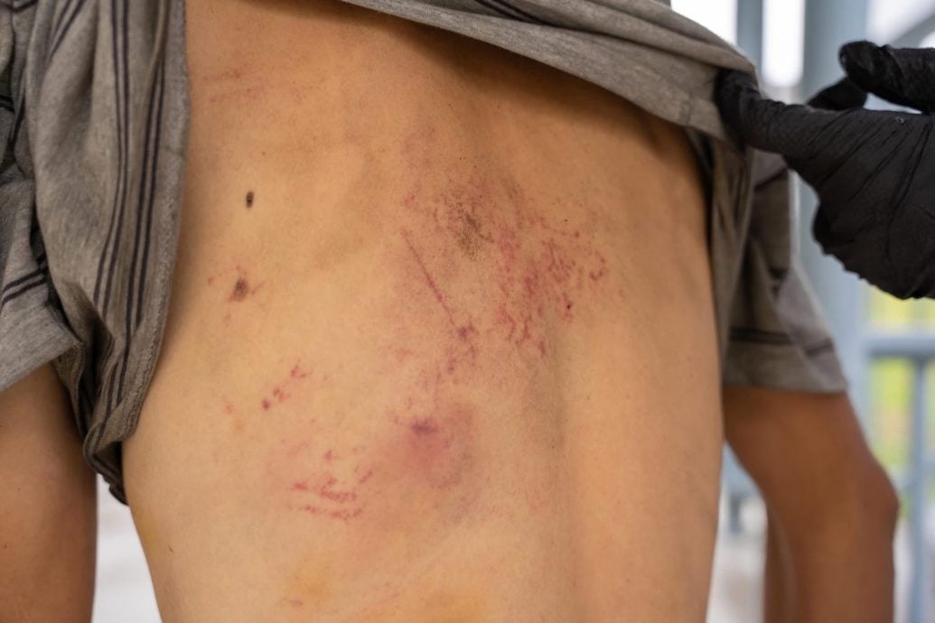 无家可归男遭劫匪打伤 马铃薯叔叔助其重建生活