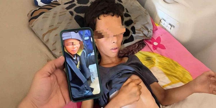 曾是运动冠军的17岁少年营养不良身亡 只剩25公斤肋骨现形