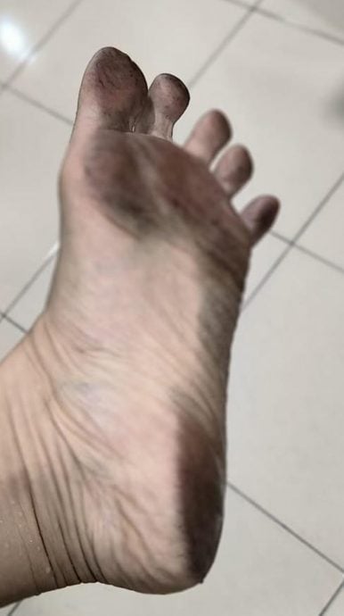 疑工厂排放污染物 太平后廊多区“污油粉”侵袭