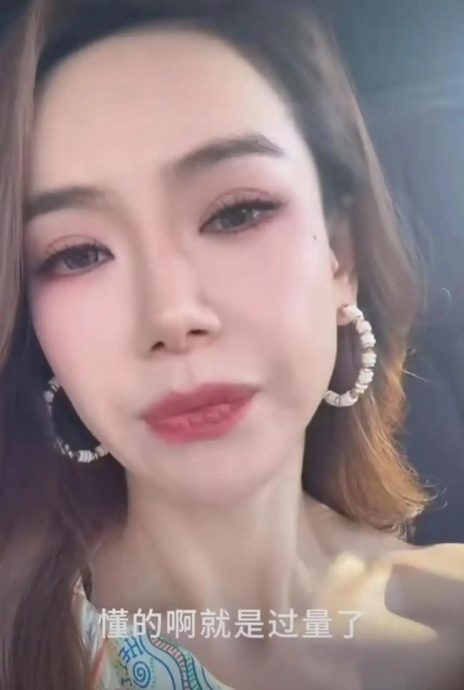 眉毛抬不动认肉毒注射过量 戚薇医美翻车反倒更圈粉