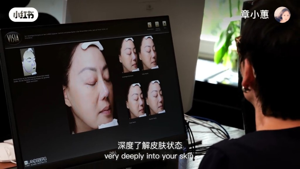 章小蕙飞欧洲奢华疗养 皮肤报告数字惊人