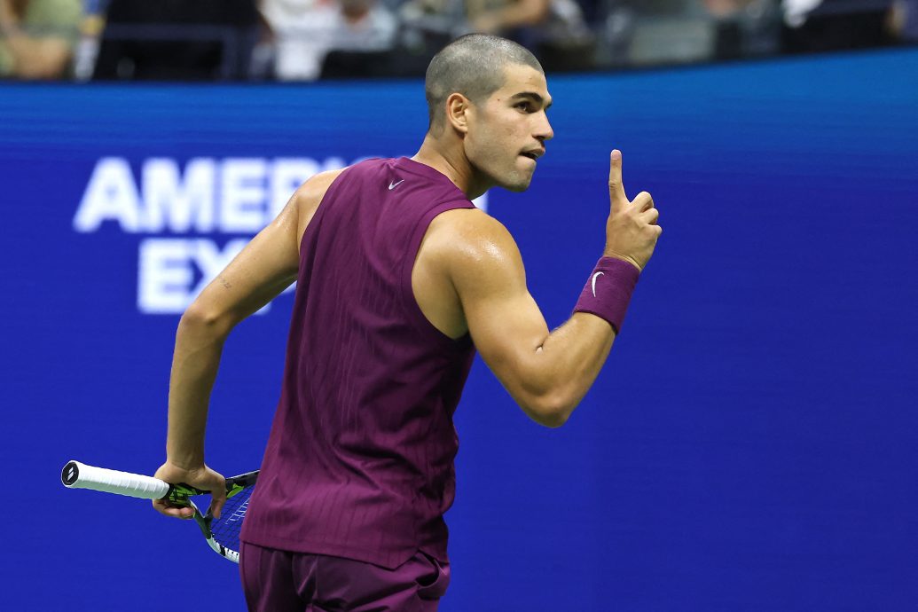 美网公开赛| 光头亮相成全场焦点  阿卡：喜欢我的新发型吗？