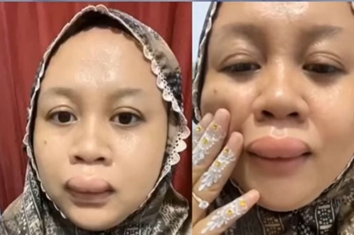 视频|结婚前夕嘴唇肿了！ 女子不理照样准备婚礼