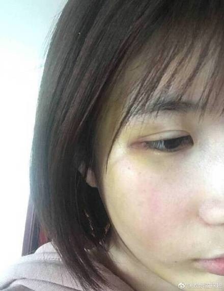 许凯被网红前任控诉家暴 原因竟是“梦见出轨”而动手