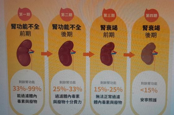 迪兰/奥客。傲慢。Ultraman