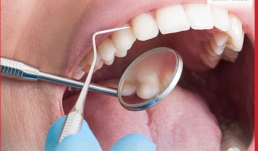 长者牙齿少过这数量  ​增添失智风险