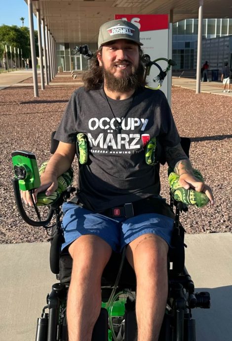 马斯克Neuralink首例受试者：大脑晶片彻底改变生活