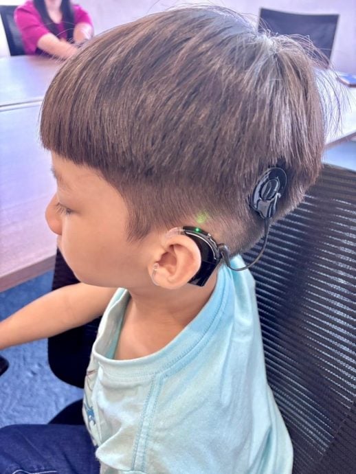 （全国版）全国首例智能人工耳蜗植入手术