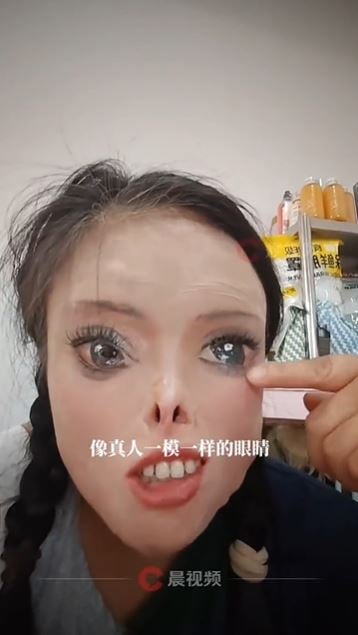 （已签发）中国女子被泼硫酸毁容 自学画画重塑五官