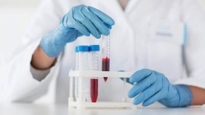 CAR-T加持 半相合移植破局 先进疗法开创血癌新希望