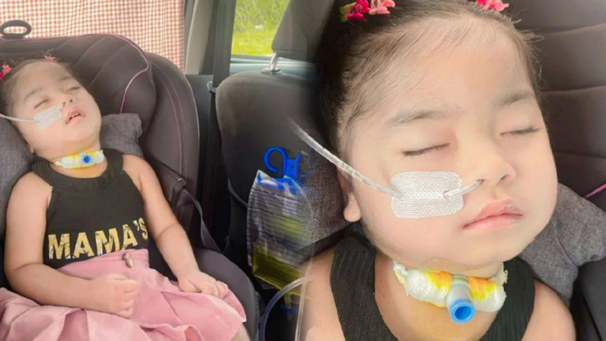 患罕病大脑与神经受损 2岁女童人生瞬间改变