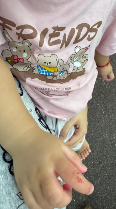 拒听饲养员指示还发脾气 黑猩猩扔石砸伤女童