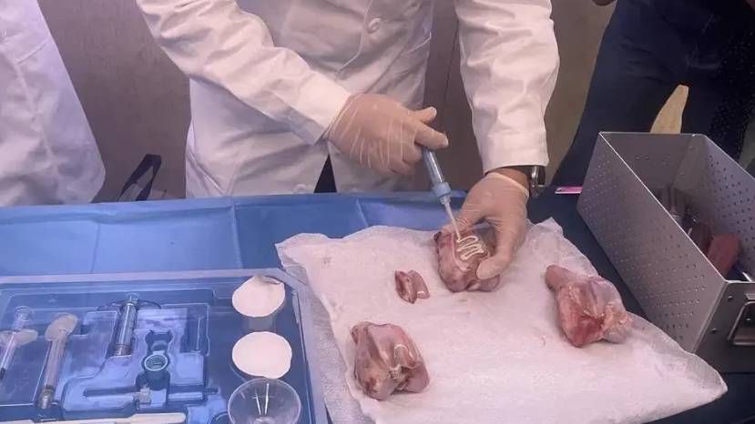 拚盘)浙大附院首创骨胶水 黏合断骨仅需3分钟