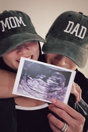 演唱会甜蜜合体晒超音波照 娄峻硕焦凡凡升格当爸妈