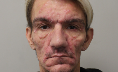 男子故意传播爱滋病毒 警急寻318名男受害者