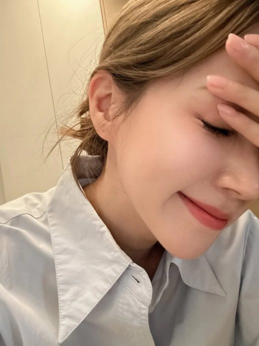 眼角膜伤势恶化痛到入急症 傅嘉莉怕永久影响视力