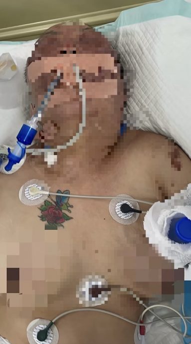 辽宁43岁妇遭前夫打裂直肠亡 女儿悲泣求严惩:要让他偿命