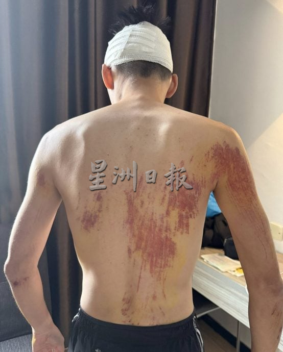 （古城版）男子参与马拉松活动被轿车撞伤