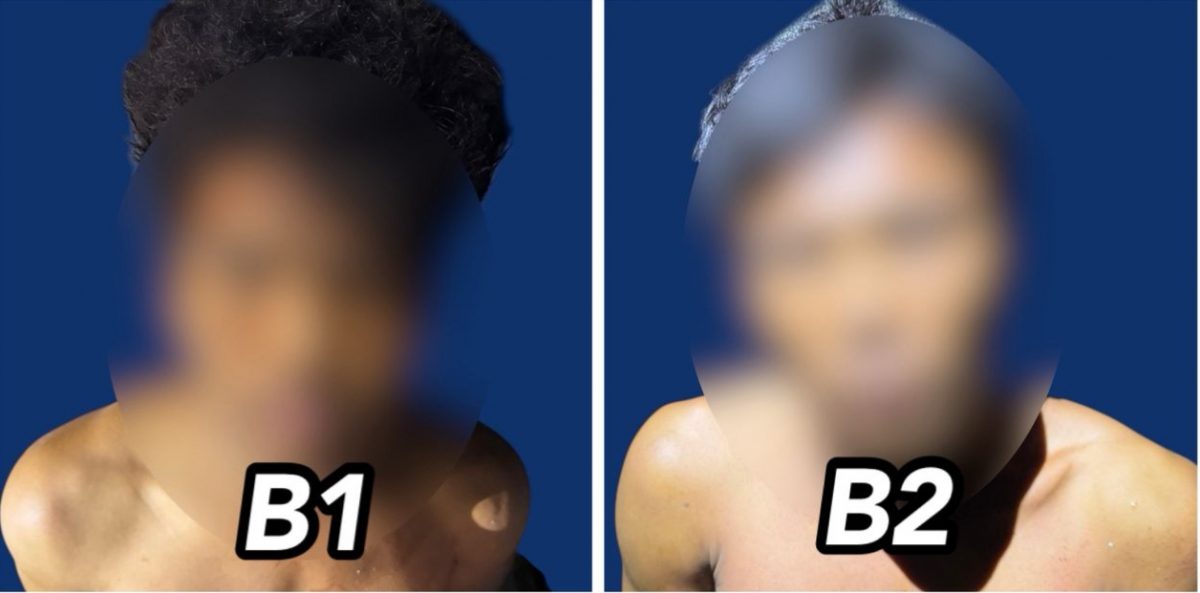 2缅男涉谋杀同乡夫妇 夫遭利器割喉亡 妻受伤