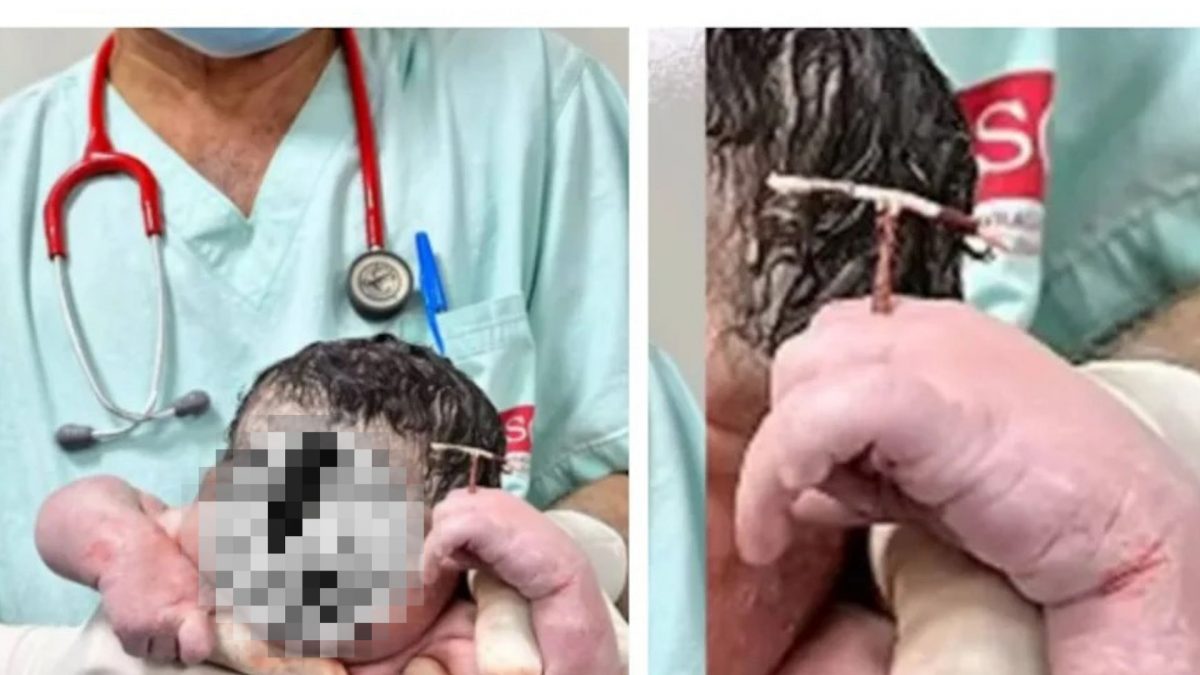 “我赢了!” 男婴手握母避孕器降生 离奇一幕掀热议!