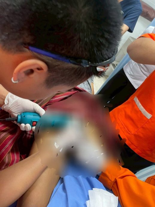 为“防盗”用钢箍锁下体? 泰男生殖器肿胀入院求救