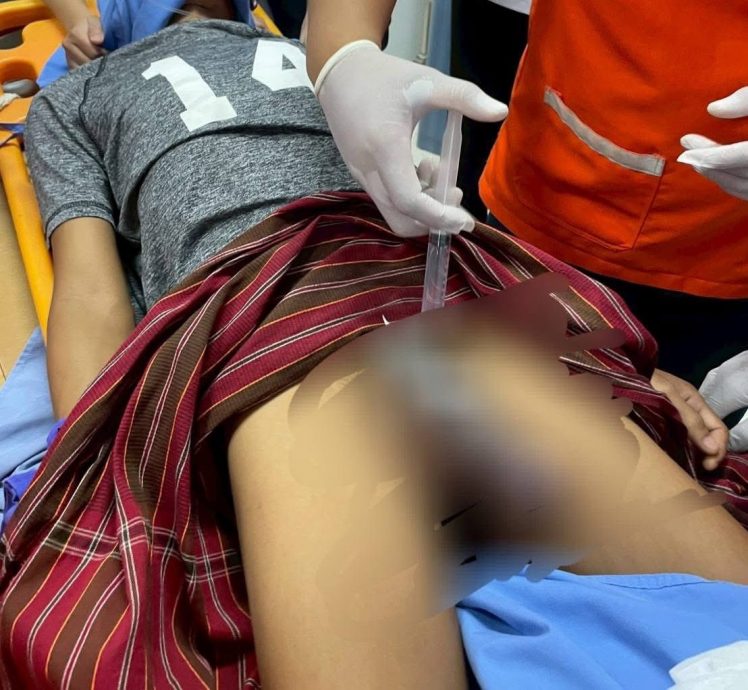 为“防盗”用钢箍锁下体? 泰男生殖器肿胀入院求救