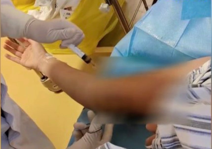 为瘦身挨百针致全身溃烂 女子双臂清创挖出57个洞