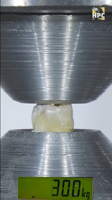供星洲网：视频|一颗牙能承受半公吨液压？网民：看了牙疼！