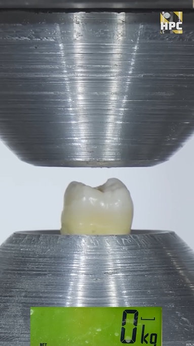 供星洲网：视频|一颗牙能承受半公吨液压？网民：看了牙疼！