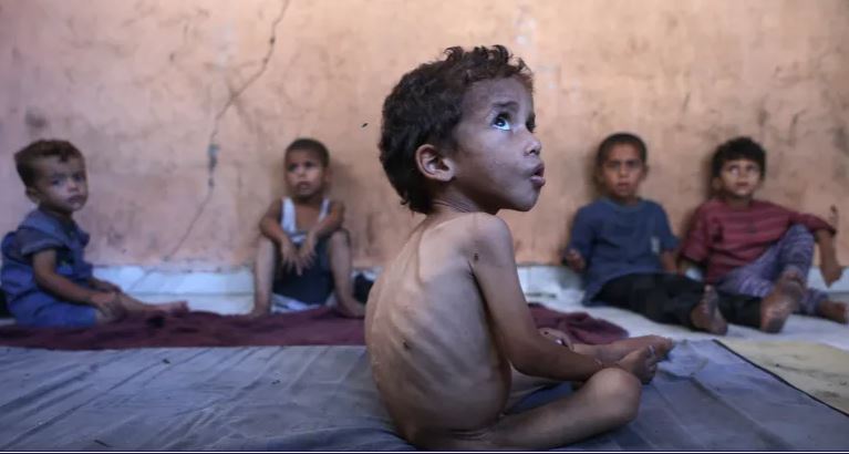 加沙“像屠宰场”|澳洲医生讲述到处是可怕血腥的残肢