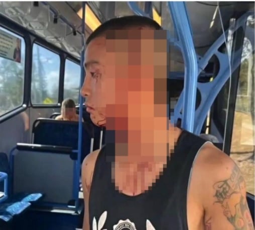 **即时国际**疑遭种族歧视 中国00后职业拳击手澳遇袭