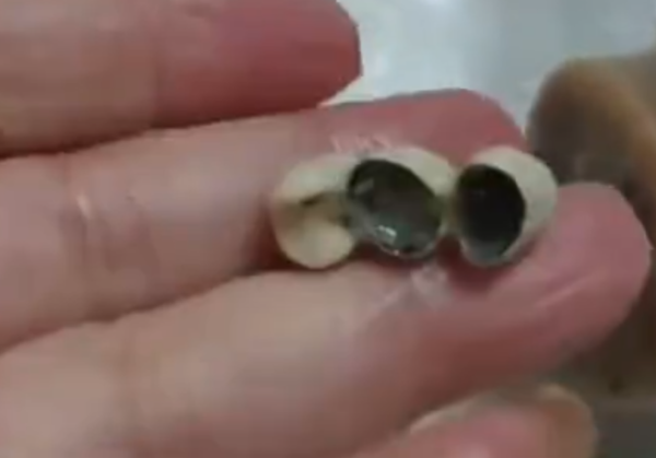 吃香肠吃到3颗牙齿 商家忙道歉网民惊呼恶心