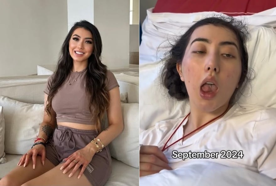 女子出国玩突中风 醒来说话变泰国腔 罕病真相曝