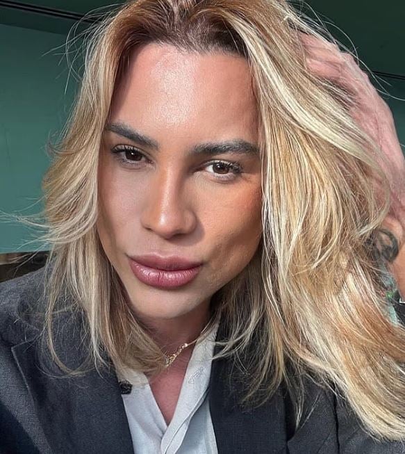 巴西时尚网红整形“狐狸眼”感染猝逝 年仅31