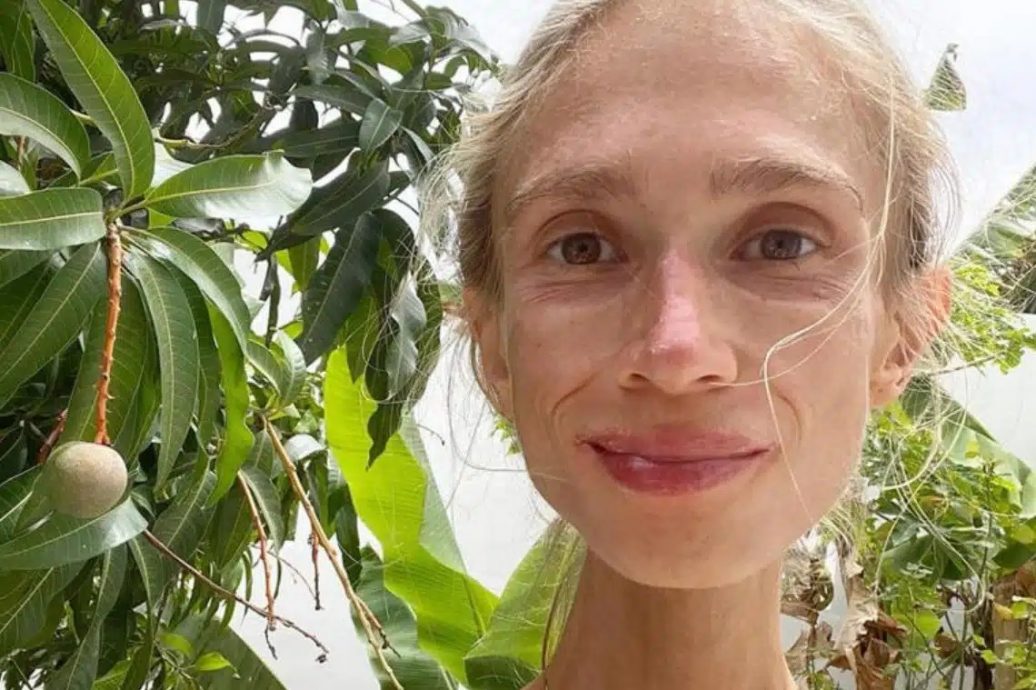 瘦成骷髅只剩22公斤! 素食女“只吃水果”活活饿死