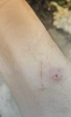 迪兰／小心猫抓！