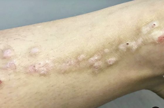 迪兰／小心猫抓！