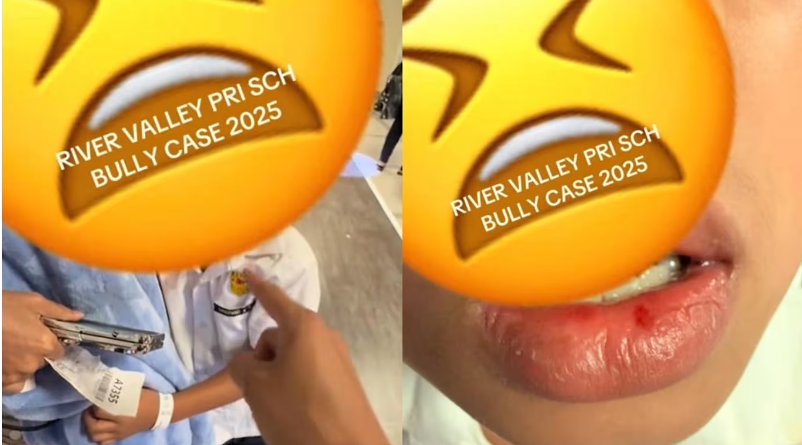 (已签发)柔:狮城二三事:家长称孩子在学校被霸凌 校方:是意外被朋友弄伤