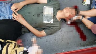 爬入儿童旋转梯玩 15岁少年撞破头