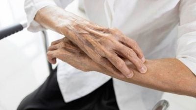 陈伟璋 / 如何改善皮肤瘙痒？ 从保养检查到用药全解析