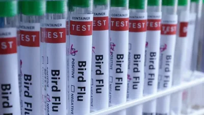 人类感染H5N5禽流感  专家：全球首例