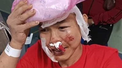 巴占大路车猛撞摩托后逃逸  事主吁目击者提供资料