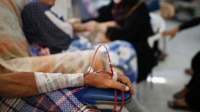 慢性肾脏病首次入列全球10大死因榜！每年悄夺150万人命