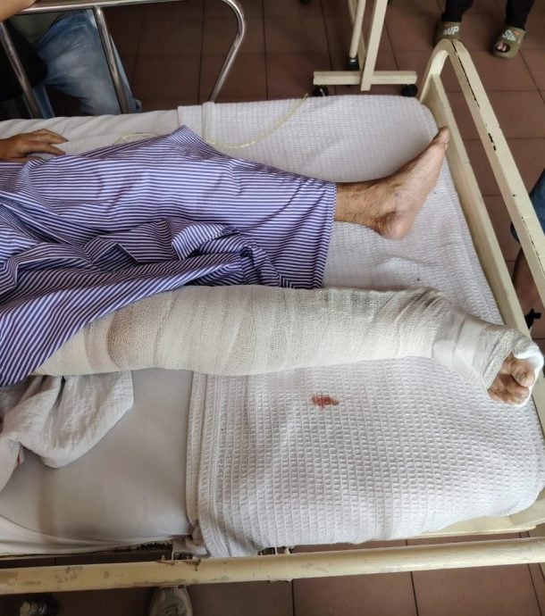 摩托车骑士撞后逃 老妇清晨散步遭撞伤入院