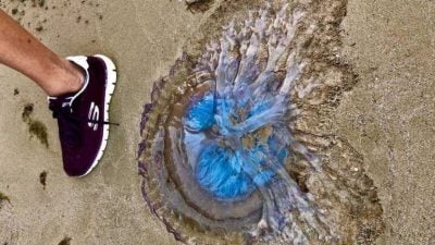 水母螫伤急救关键30秒！卫生部:用醋冲洗不是尿