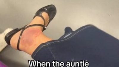 称脚伤拒让博爱座闹剧反转 女子自曝淤青是脚环印！